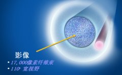 美國Endo Optiks E2眼內窺鏡 